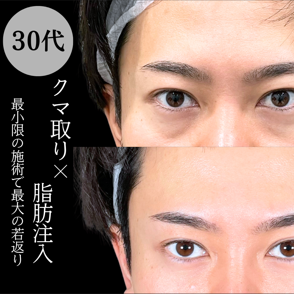 No.18487の症例写真