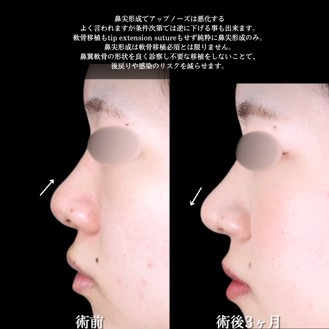 No.18535の症例写真1