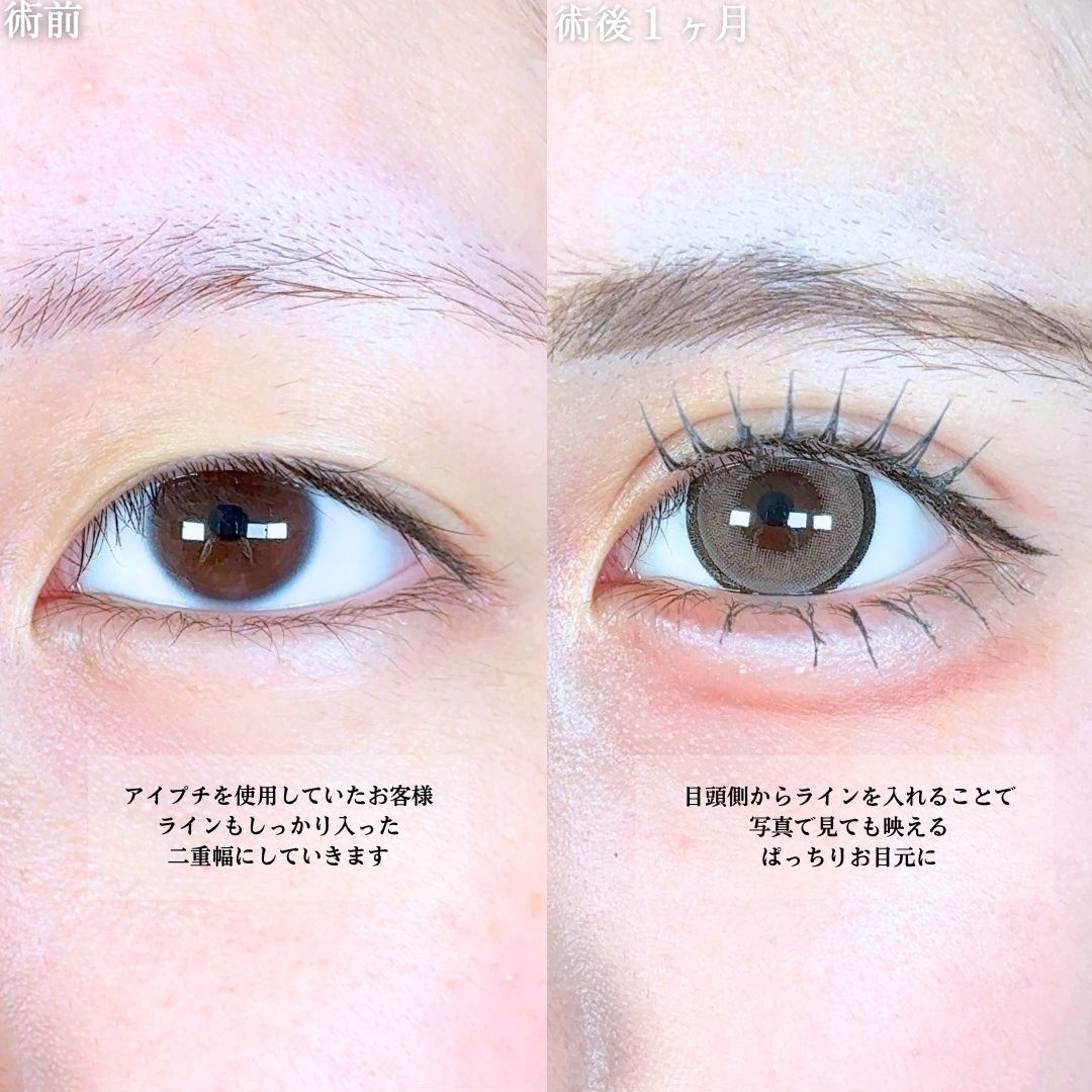 No.18523の症例写真1