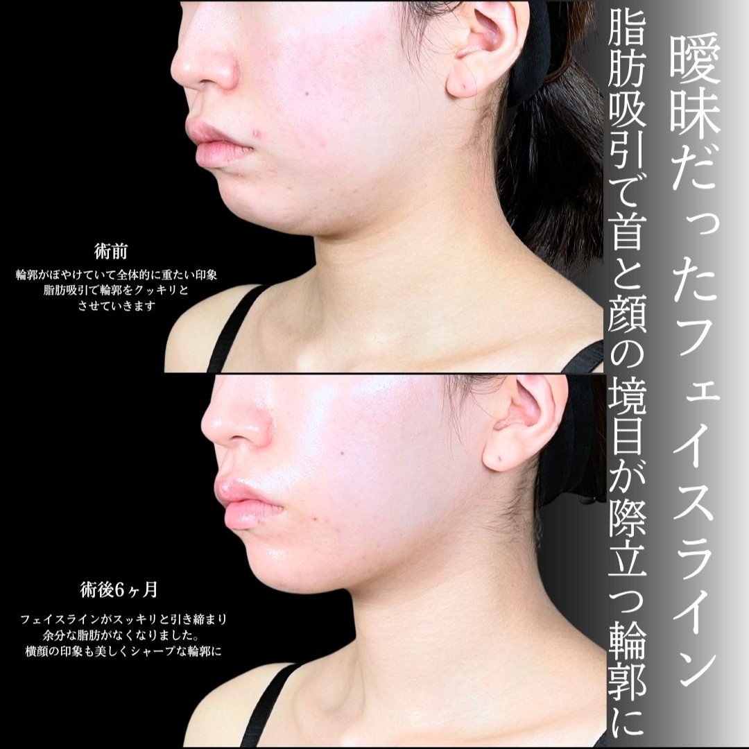 No.18572の症例写真1