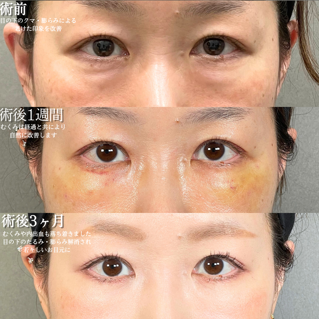 No.18638の症例写真1