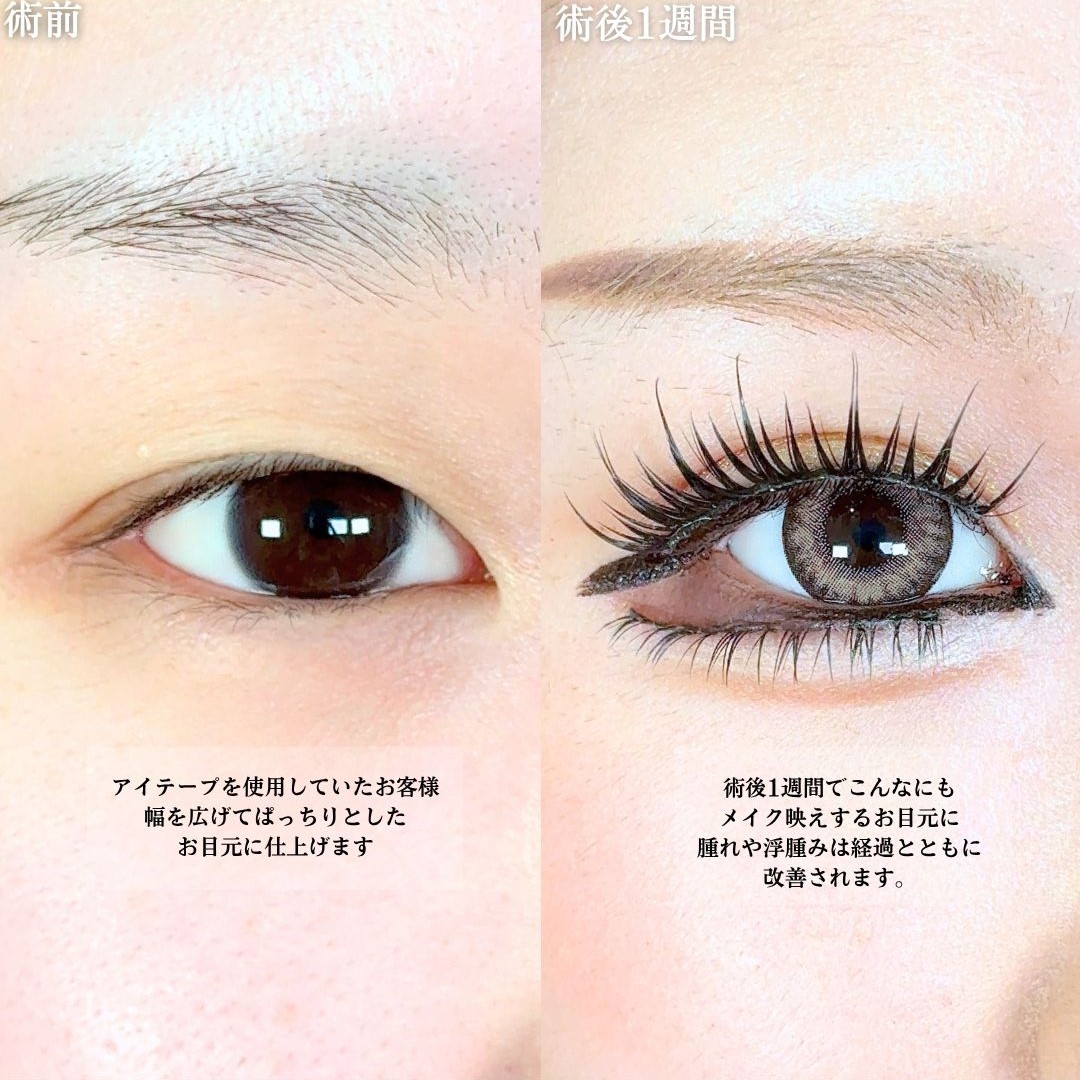 No.18595の症例写真1