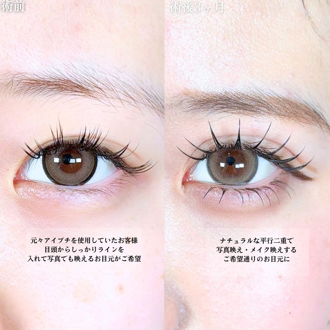 No.18690の症例写真1