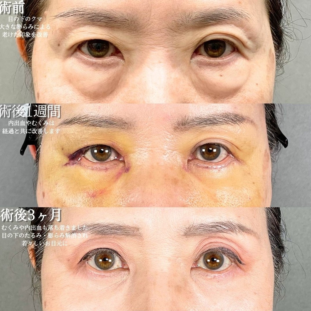 No.18782の症例写真1