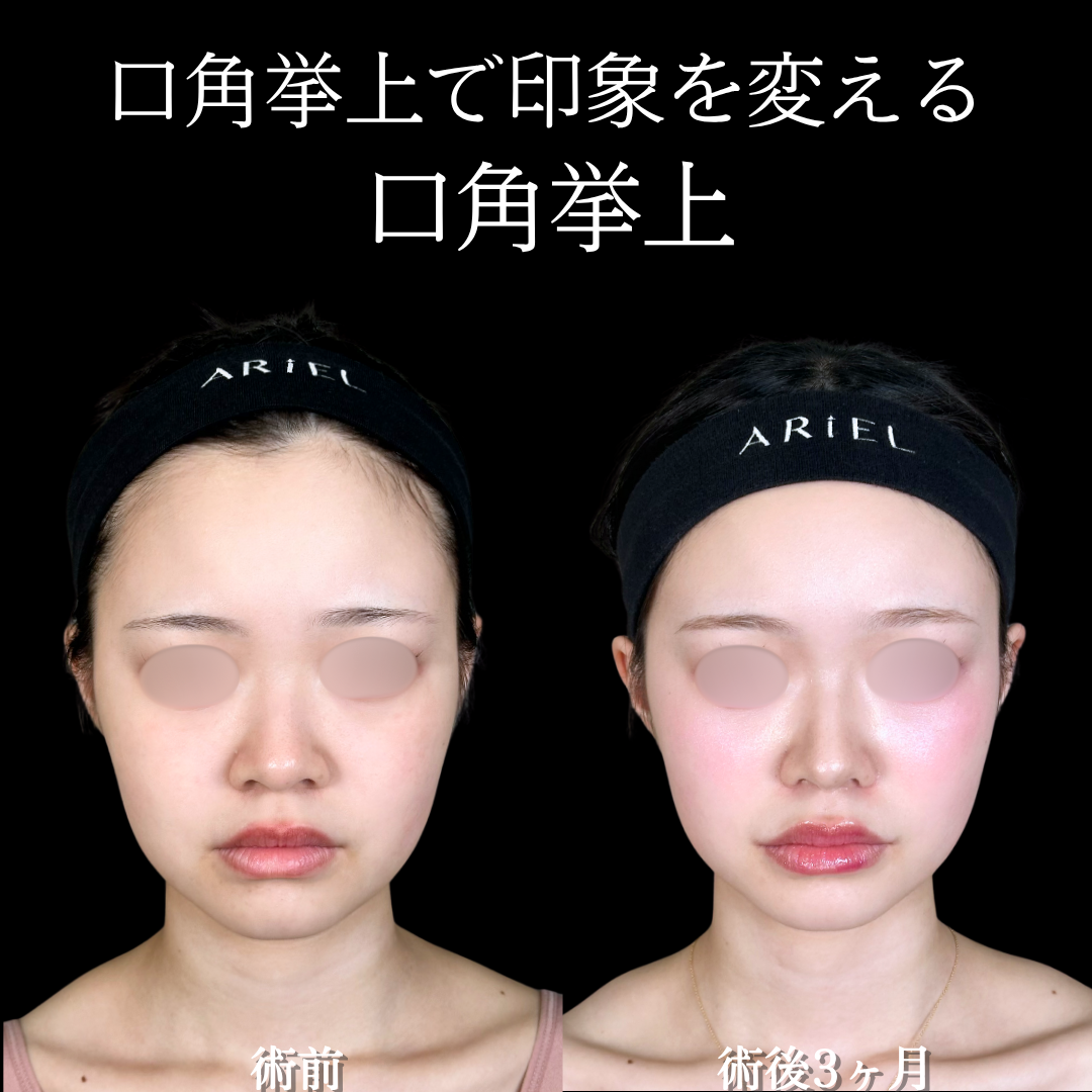 No.18790の症例写真