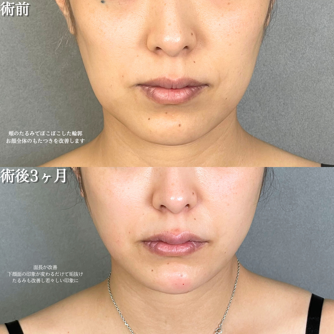 No.18925の症例写真1