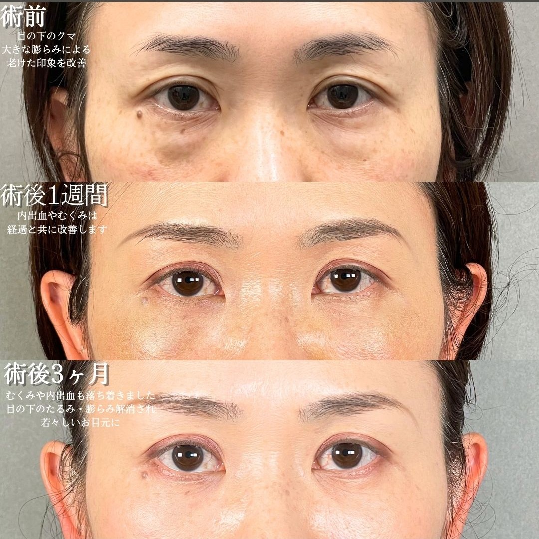 No.18827の症例写真1