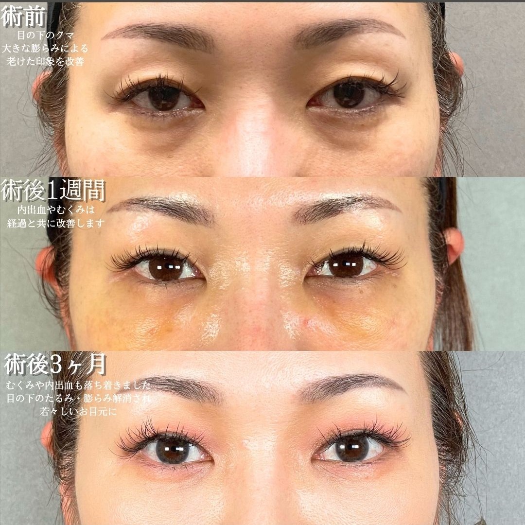 No.18951の症例写真1