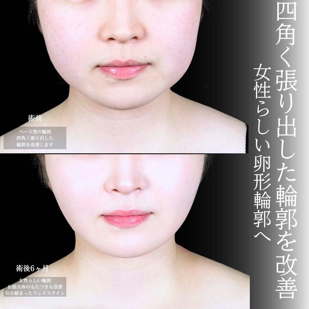 No.18494の症例写真1