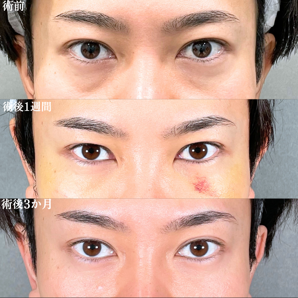 No.18487の症例写真1