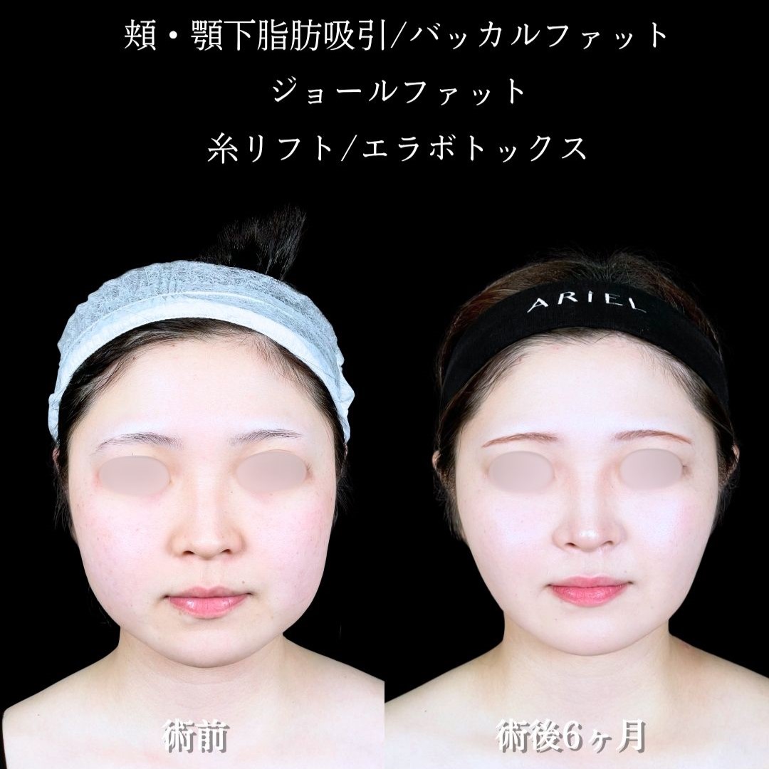 No.18494の症例写真2