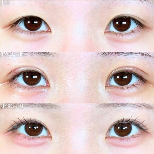 No.18812の症例写真