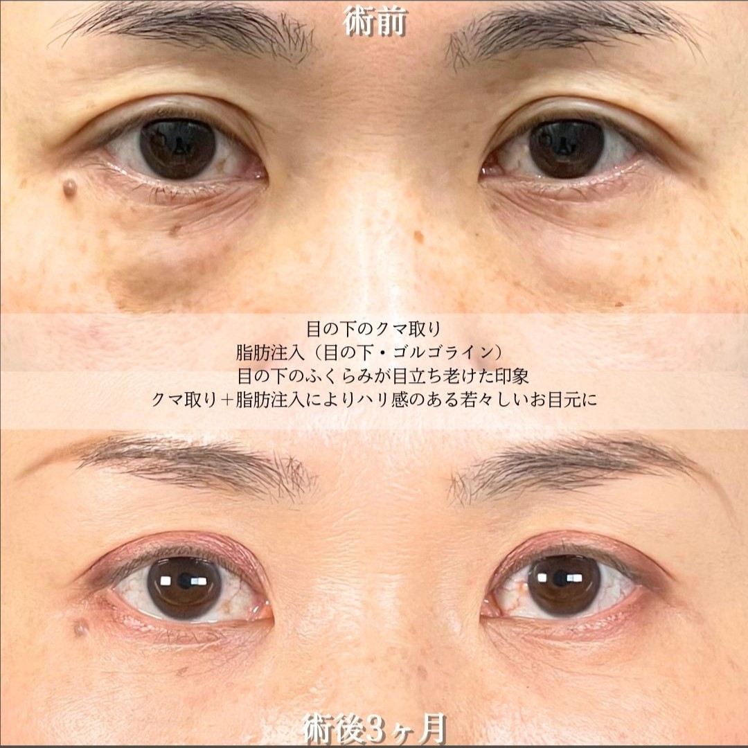 No.18827の症例写真2