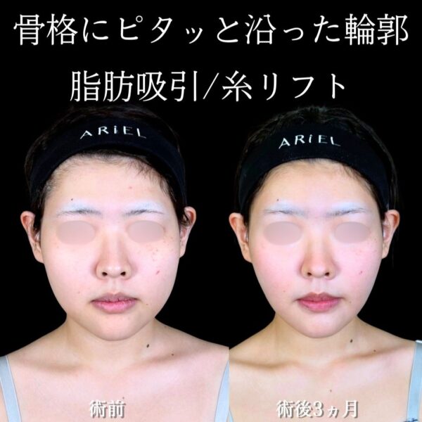 No.18913の症例写真