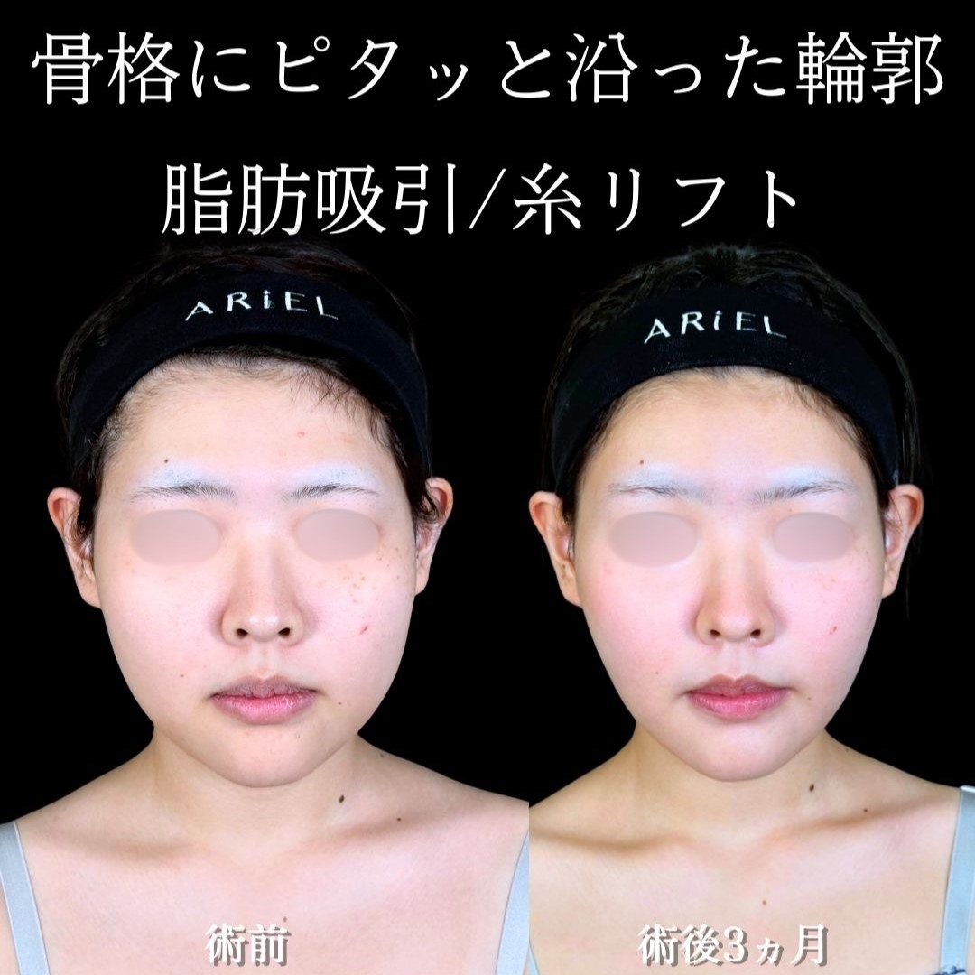 No.18913の症例写真