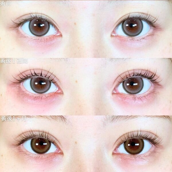 No.18940の症例写真