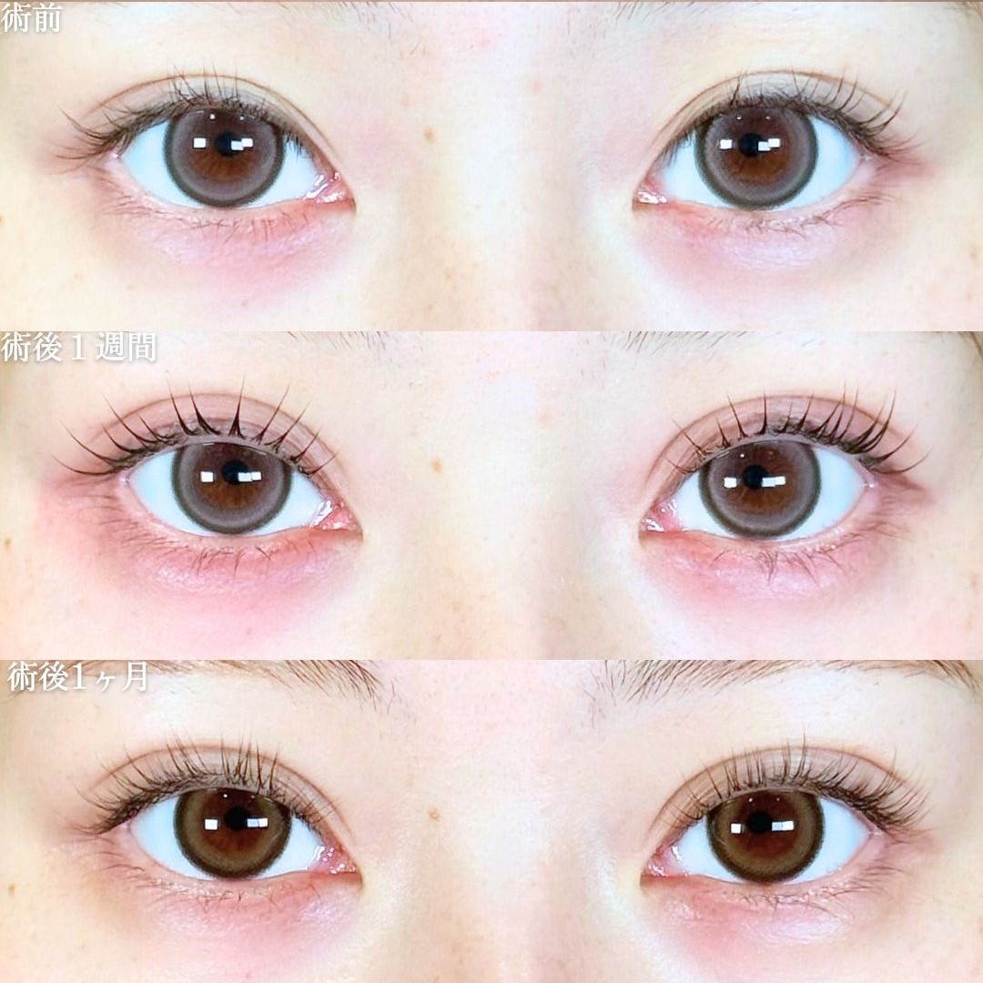 No.18940の症例写真