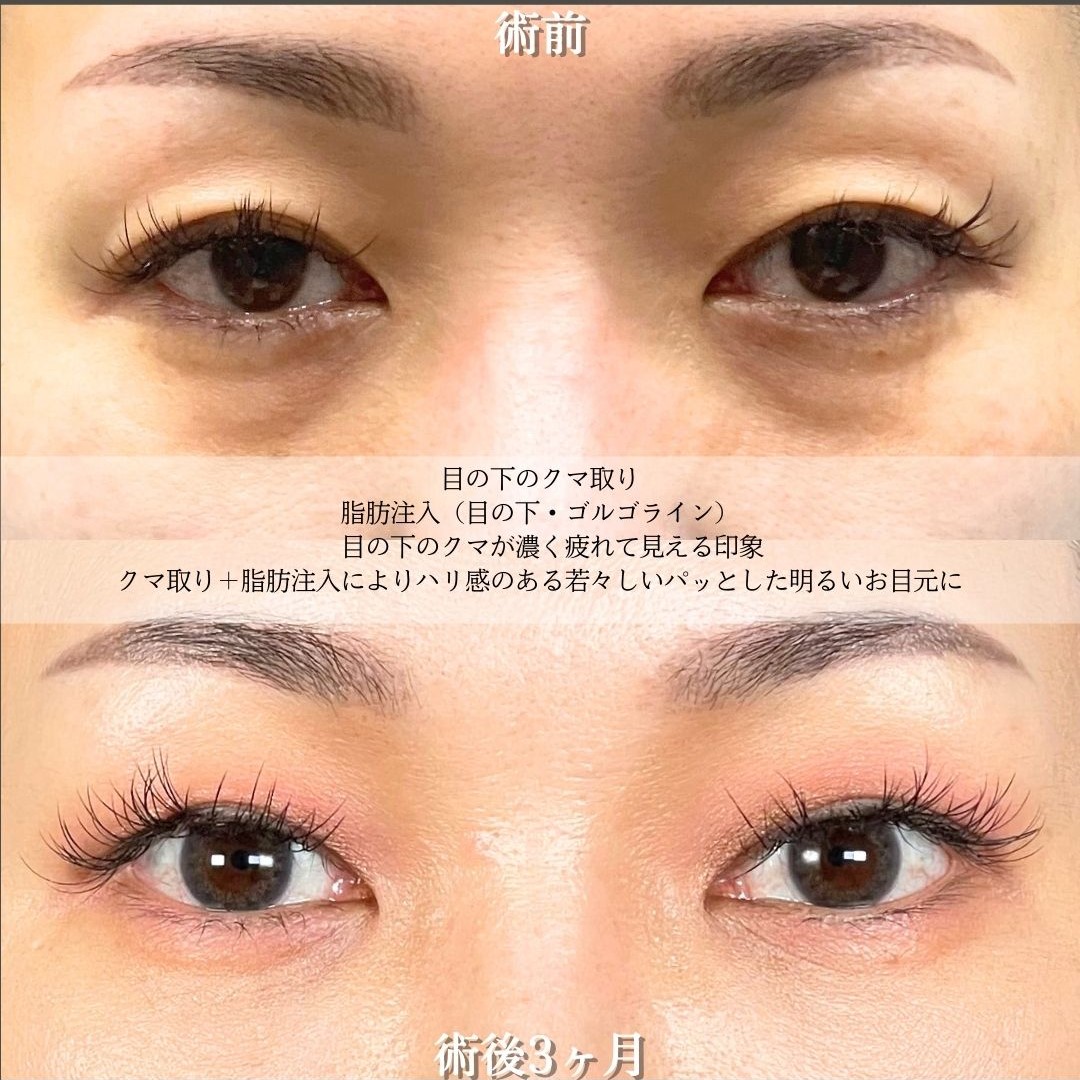 No.18951の症例写真2