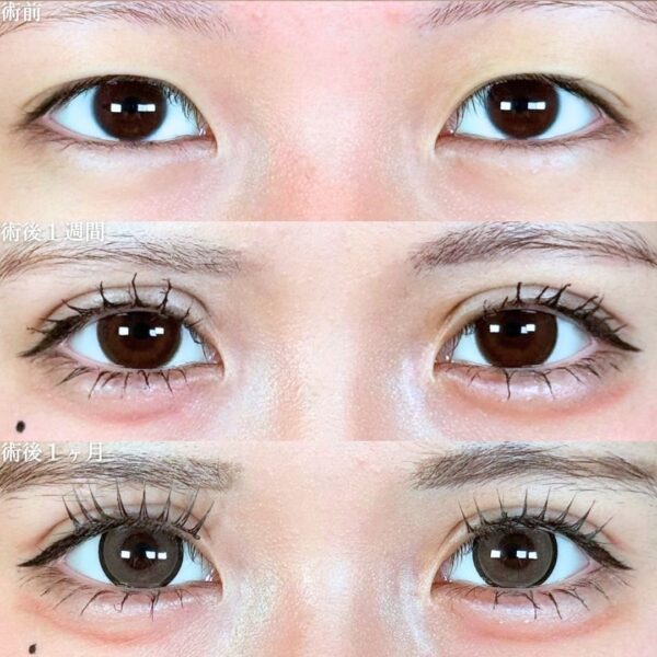 No.18506の症例写真