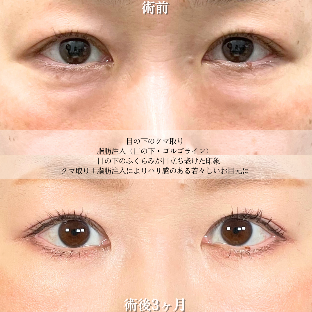 No.18638の症例写真2