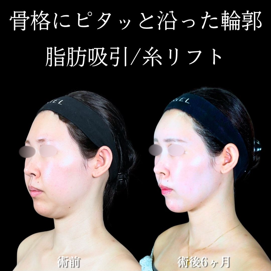 No.18553の症例写真