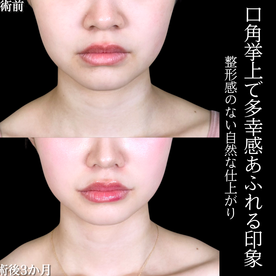 No.18790の症例写真1