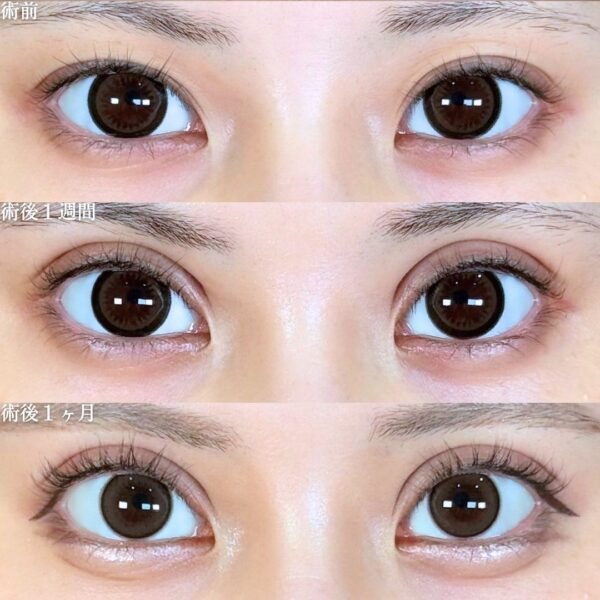 No.18570の症例写真 No.18570の症例写真