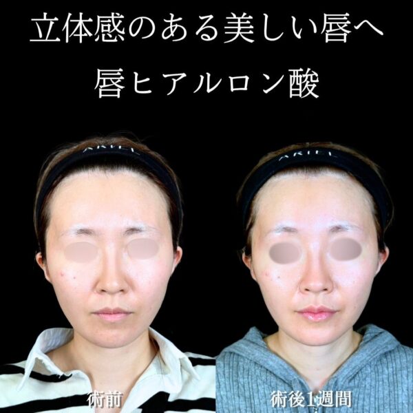 No.18630の症例写真 No.18630の症例写真