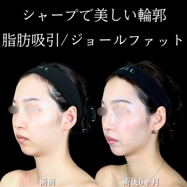 No.18477の症例写真