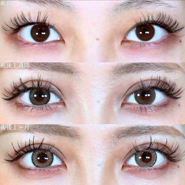 No.18653の症例写真 No.18653の症例写真