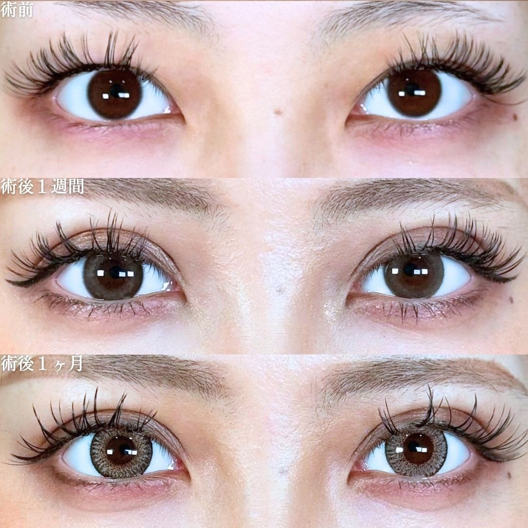 No.18653の症例写真