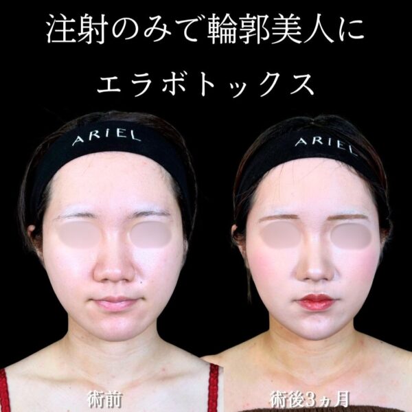 No.18776の症例写真 No.18776の症例写真