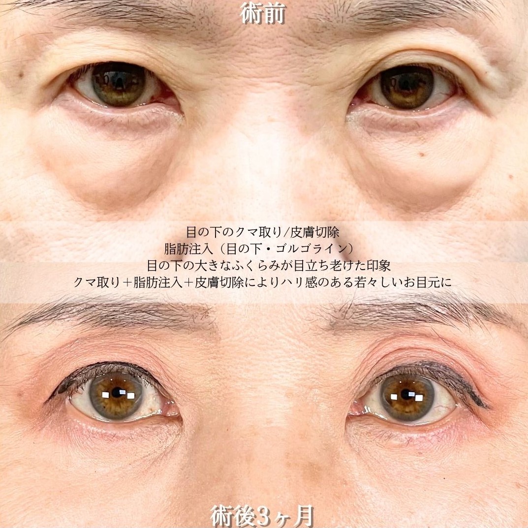 No.18782の症例写真2