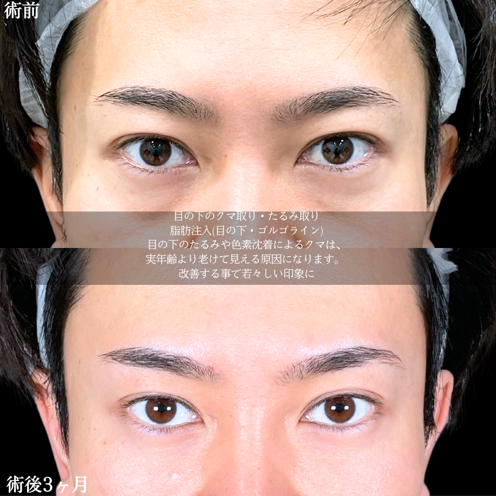 No.18487の症例写真2