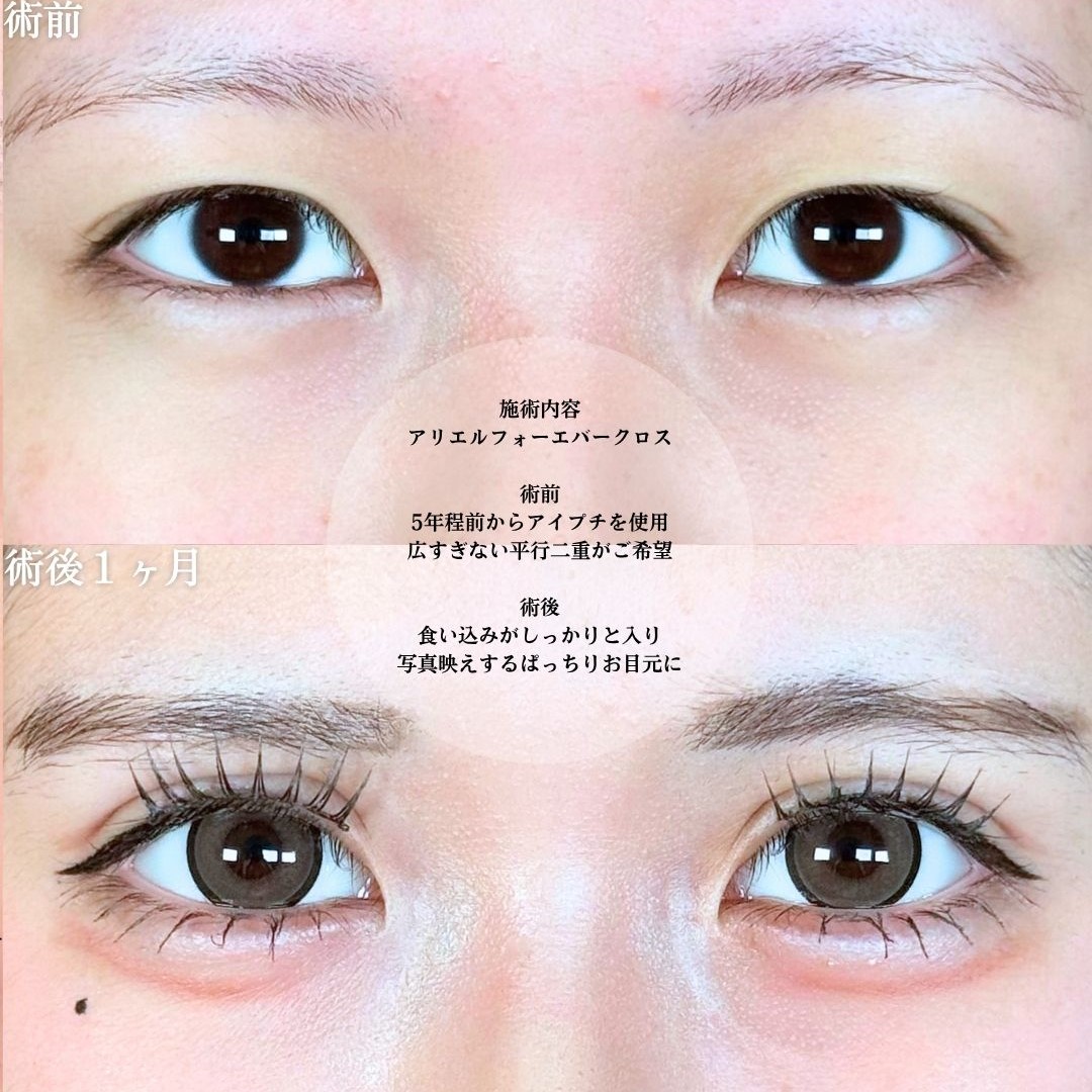 No.18506の症例写真1