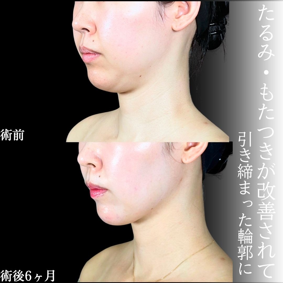 No.18553の症例写真1