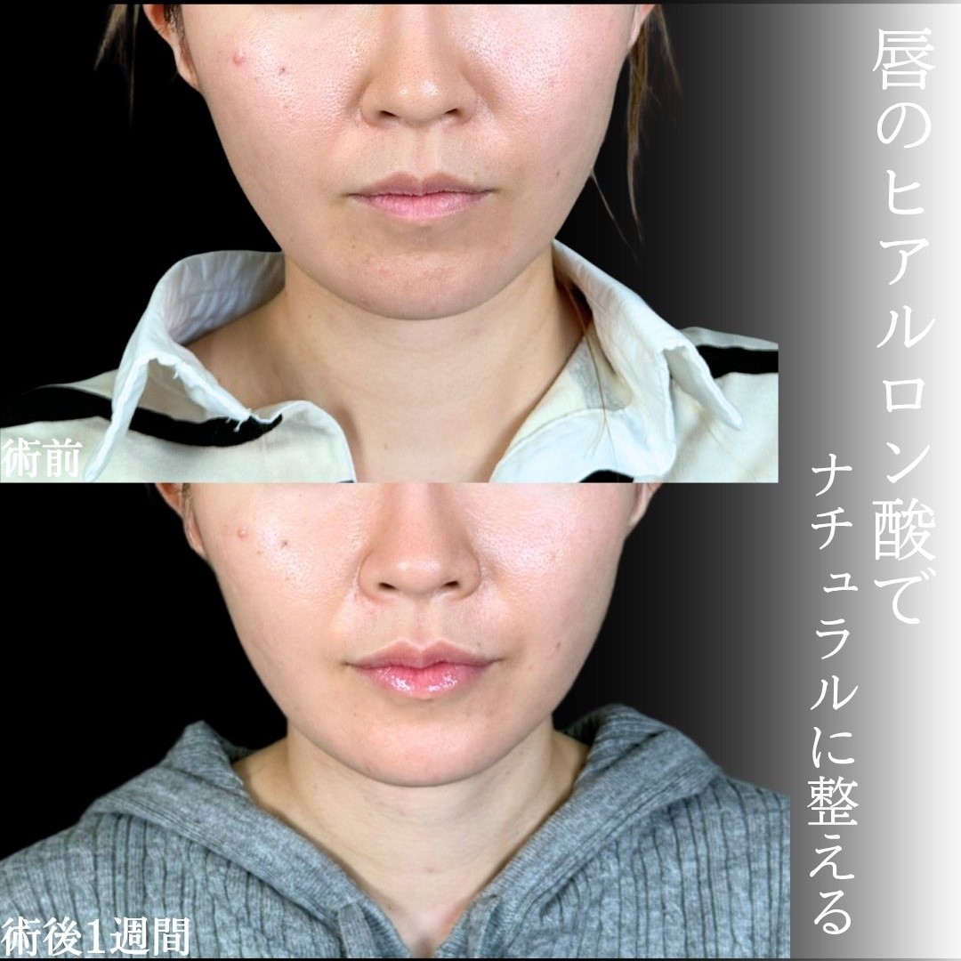 No.18630の症例写真1