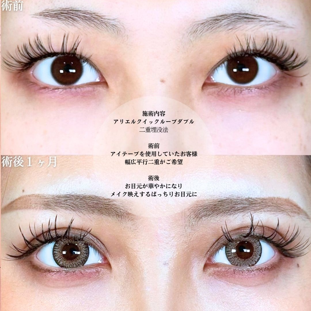 No.18653の症例写真1