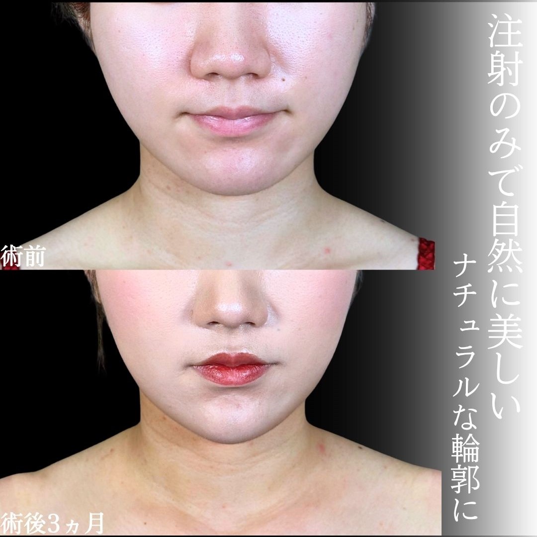 No.18776の症例写真1