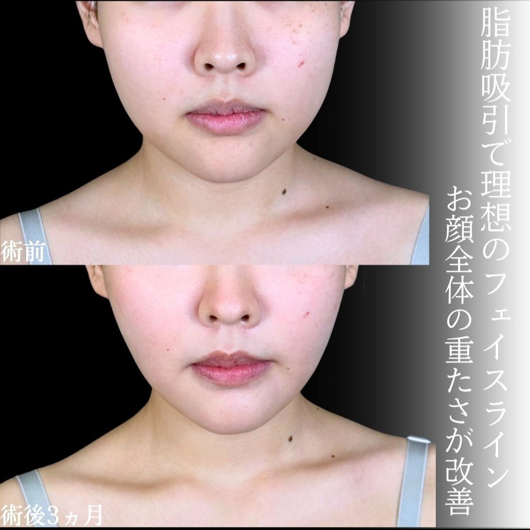 No.18913の症例写真1