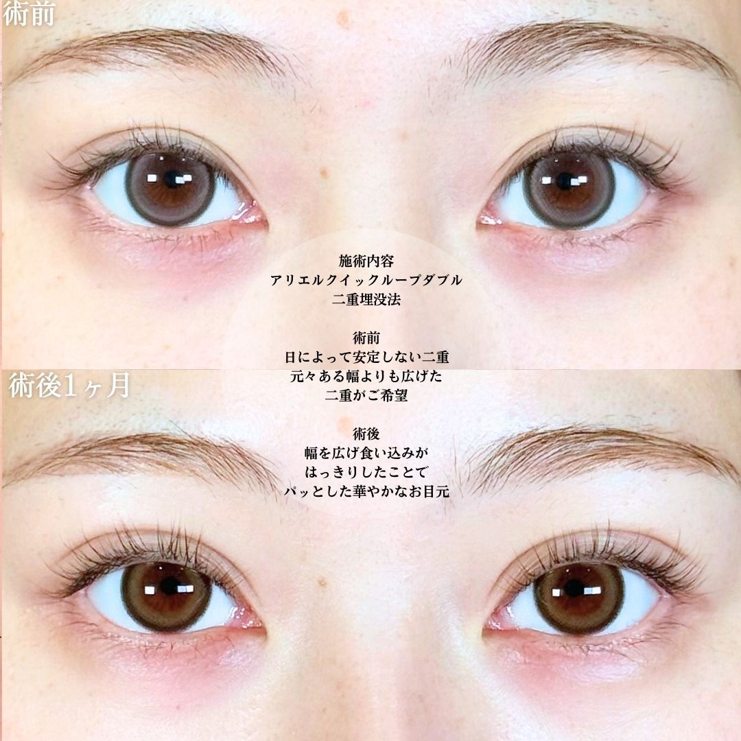 No.18940の症例写真1