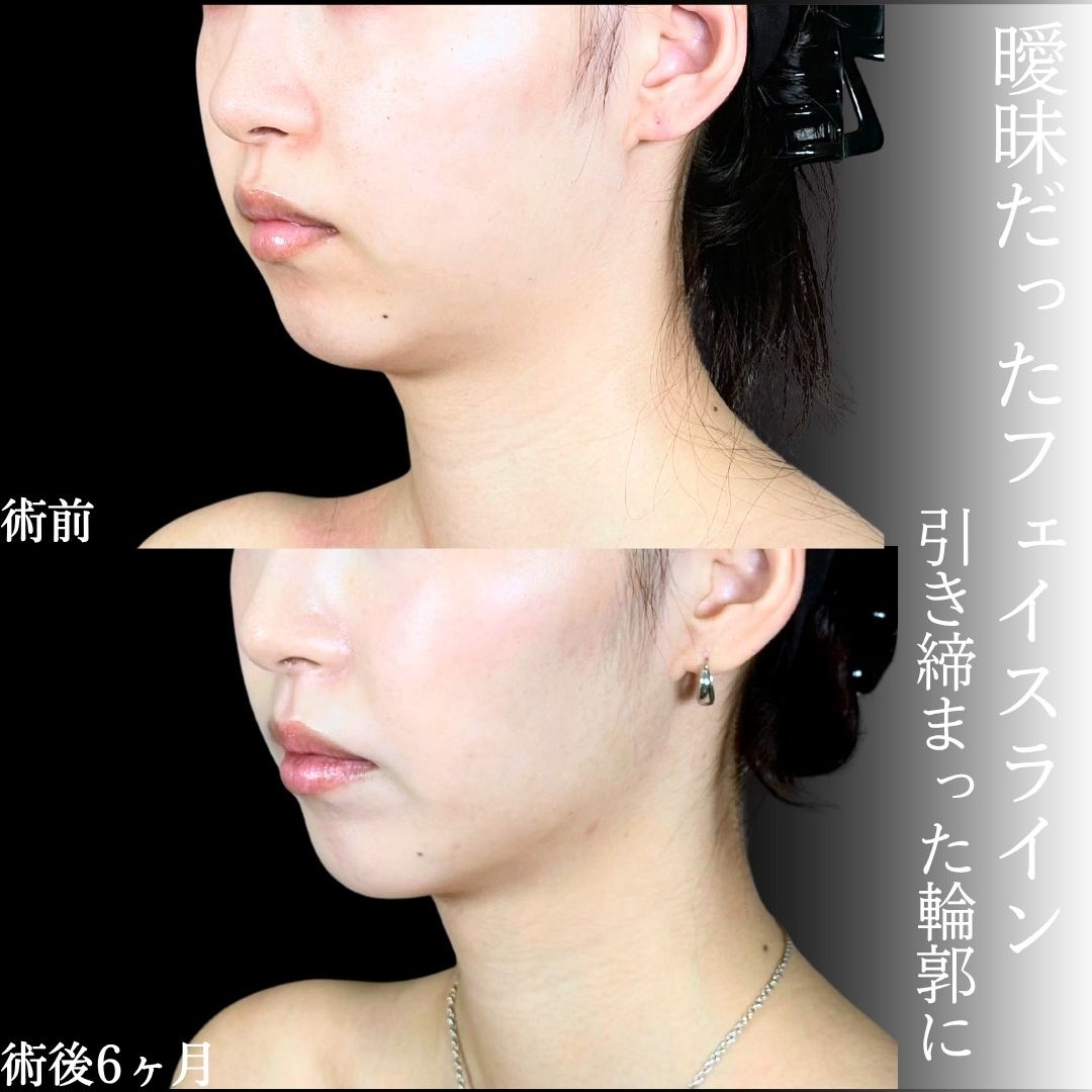 No.18477の症例写真1