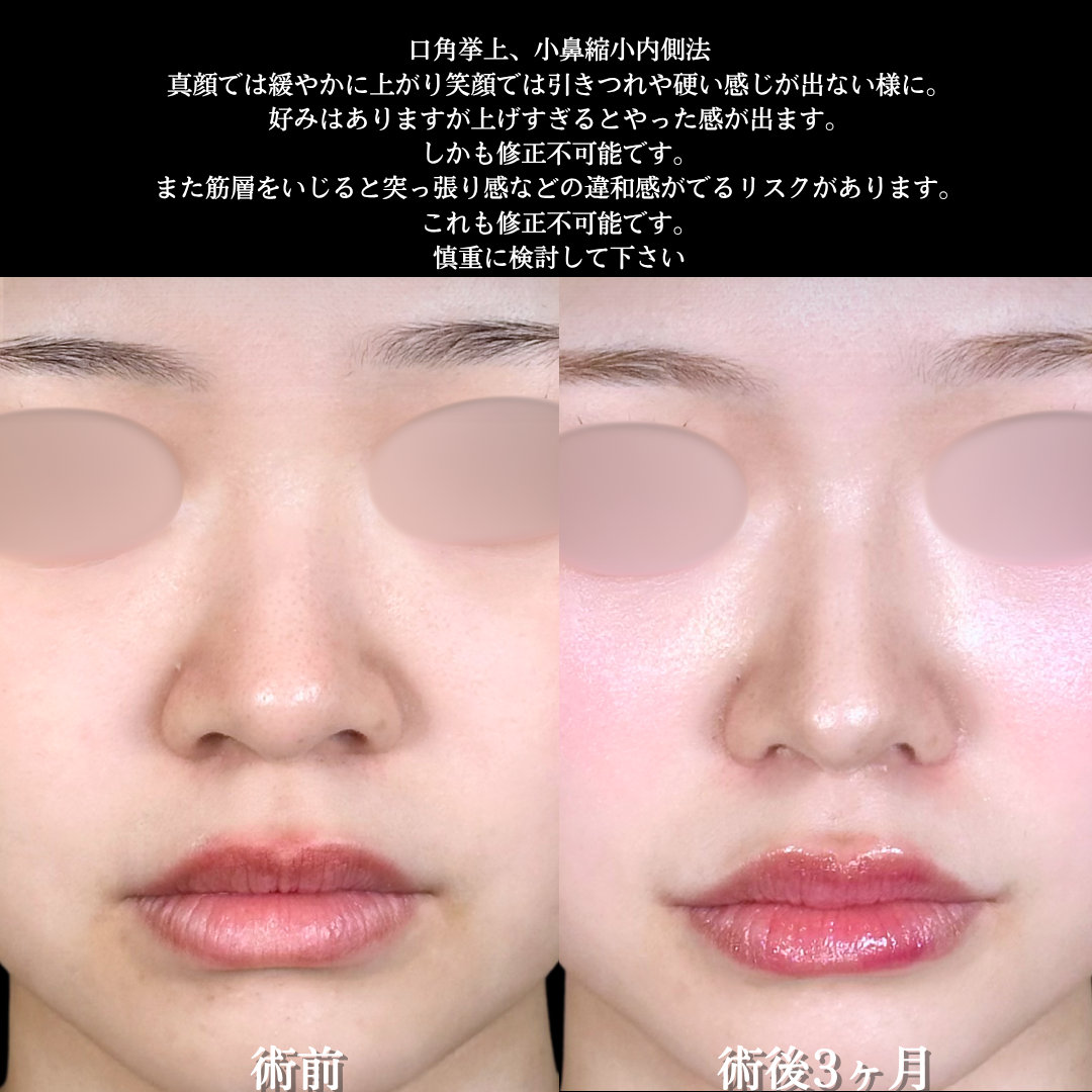 No.18790の症例写真2