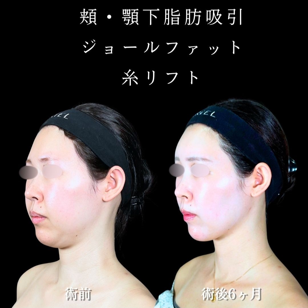 No.18553の症例写真2