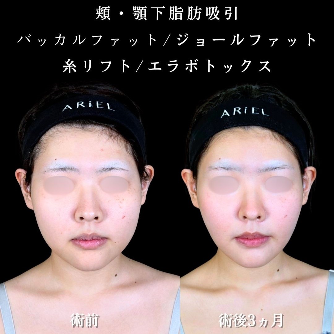 No.18913の症例写真2