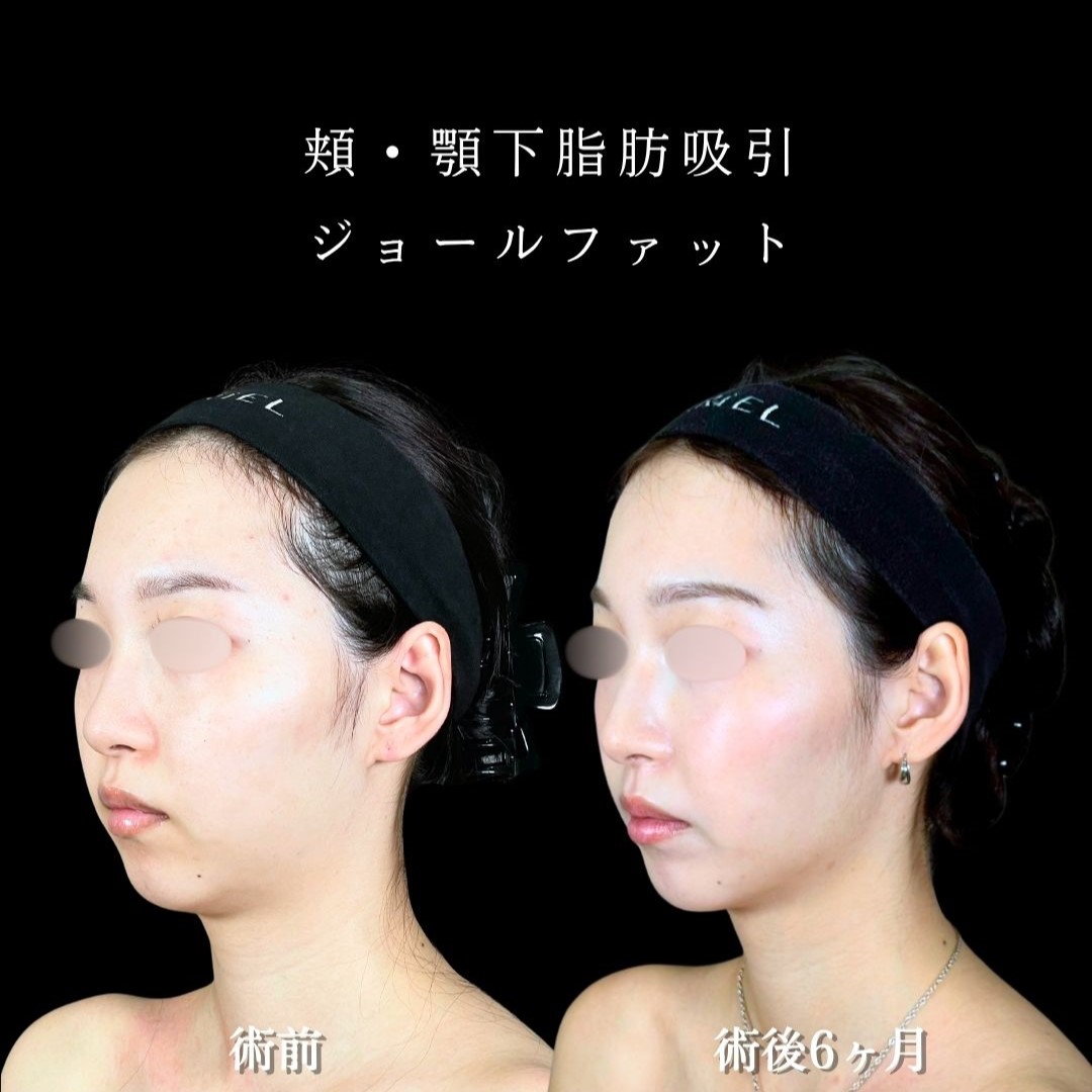 No.18477の症例写真2