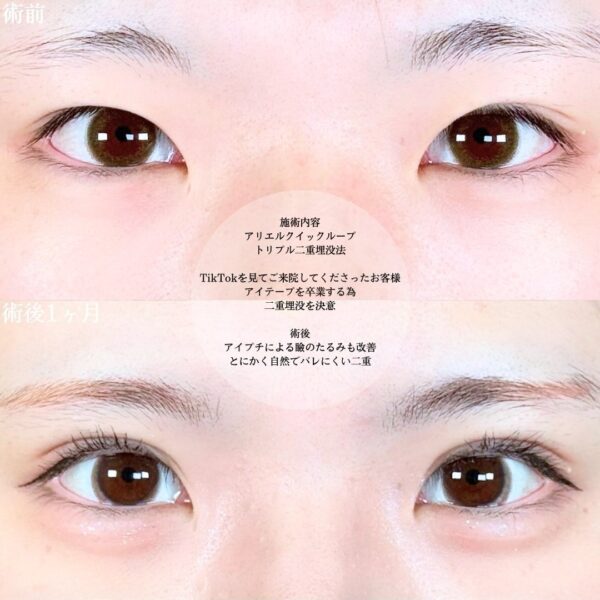 No.18696の症例写真 No.18696の症例写真