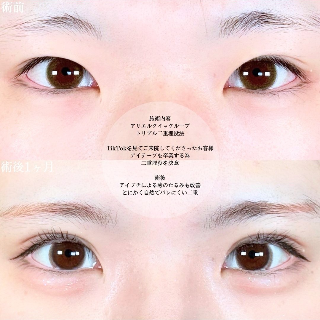 No.18696の症例写真