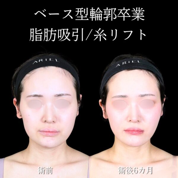 No.18819の症例写真