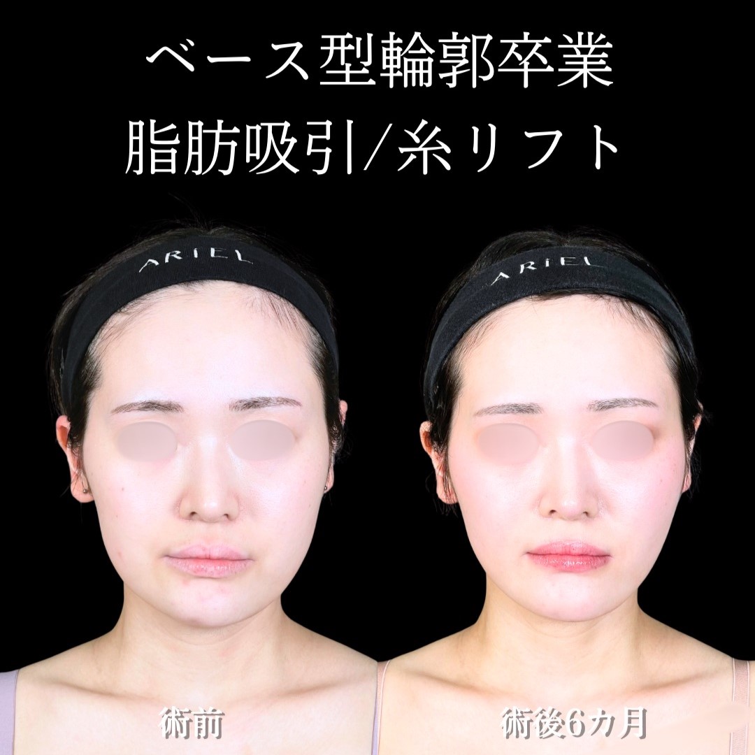 No.18819の症例写真